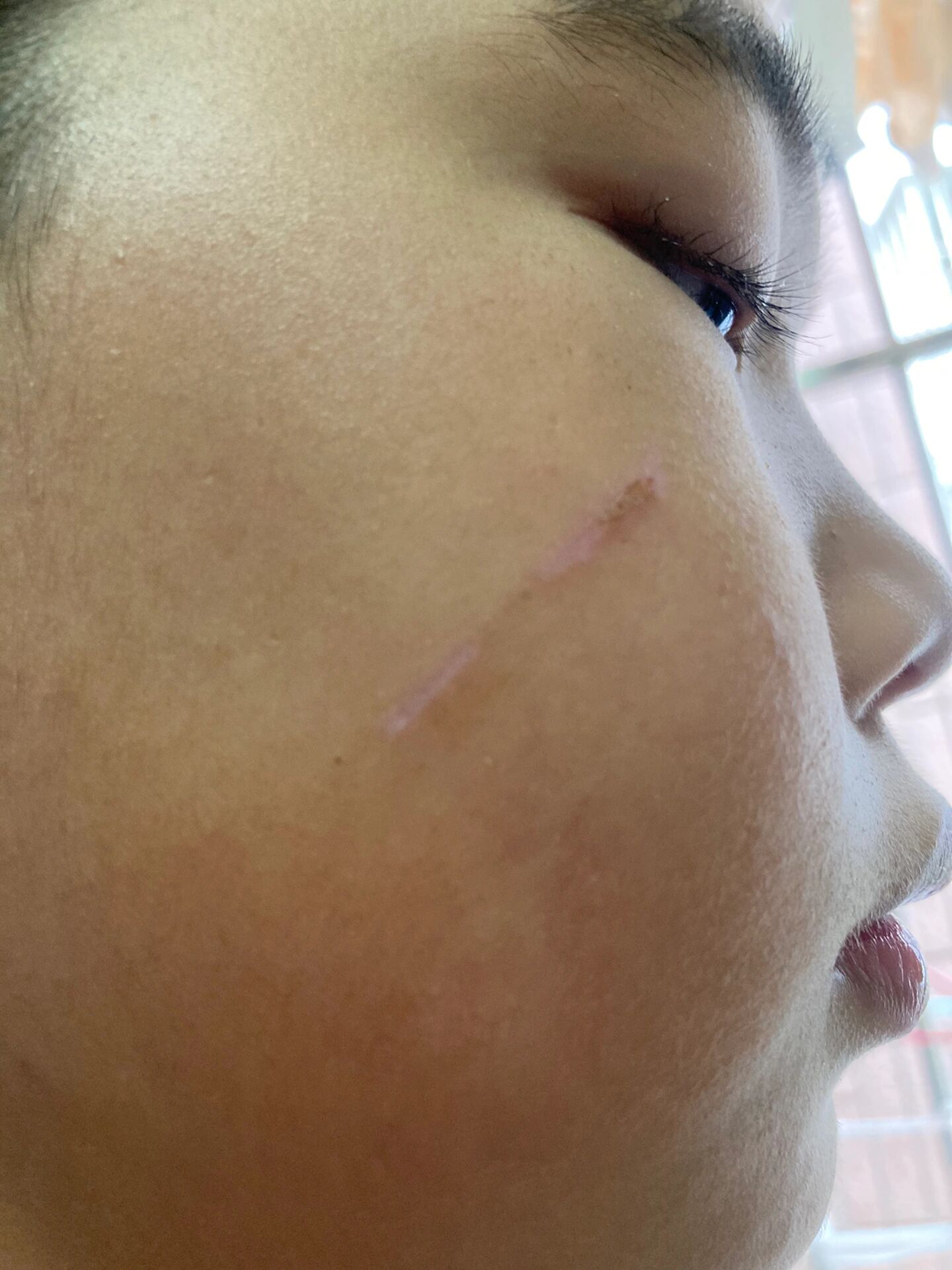 男医生说不要紧过段时间自己会好的,药都不用擦,还是好担心有去皮肤科