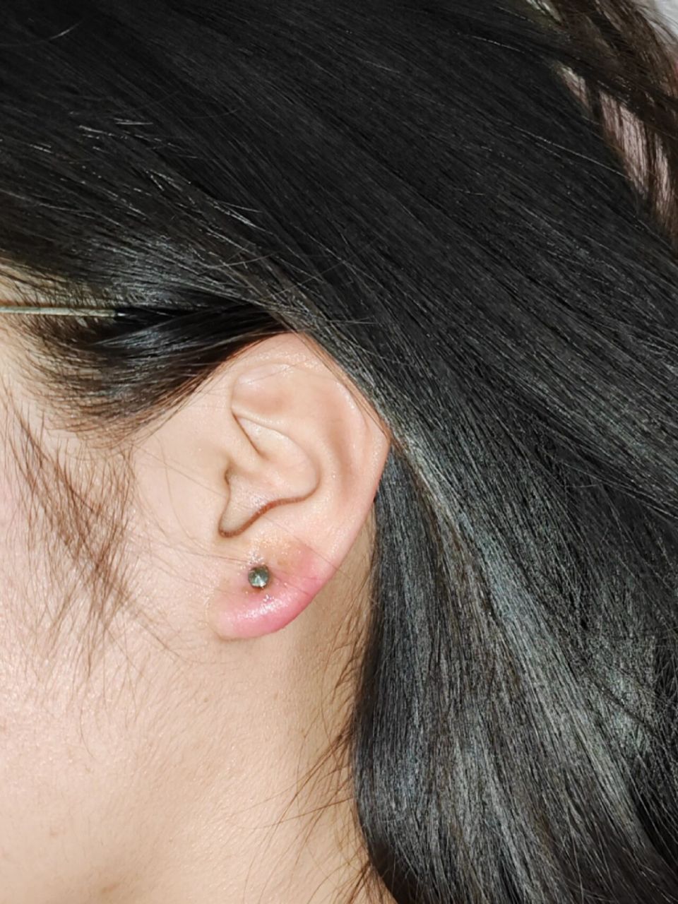 耳洞红肿可以换银耳钉吗 打耳洞的第五天,还是红肿痛,好多人都说第