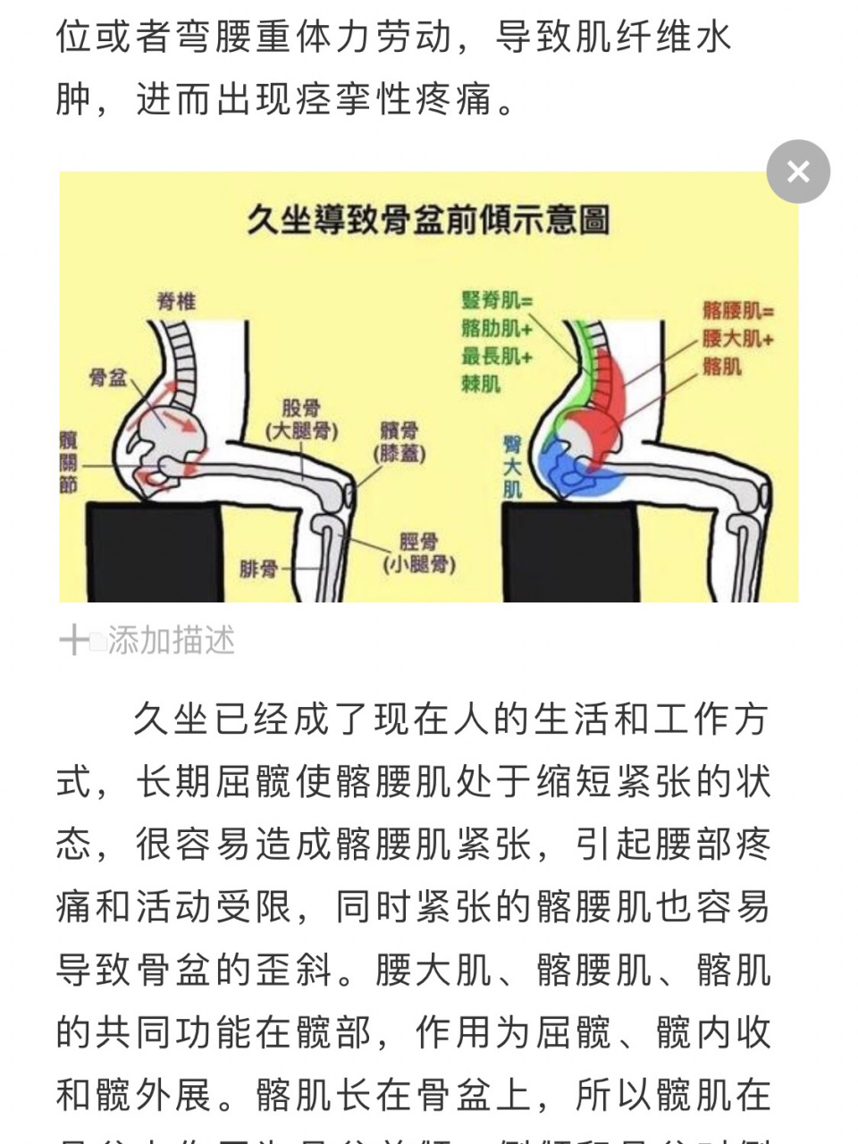 髂腰肌起止点图片