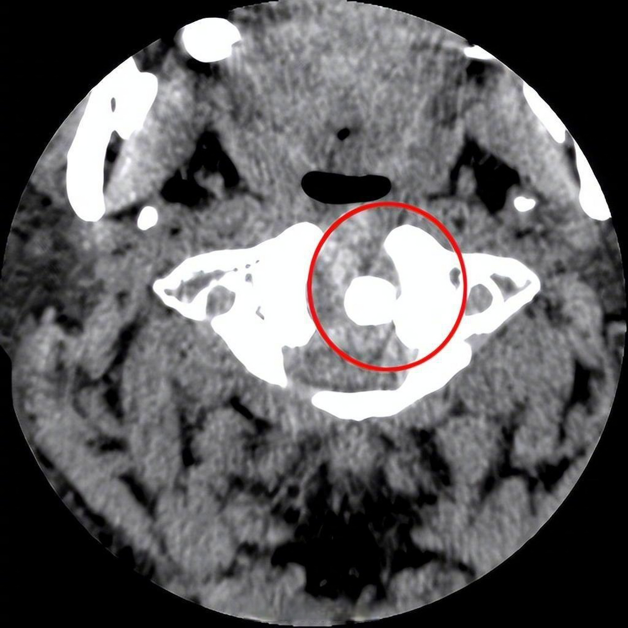 男子车祸后身体"带电",终于揭开真相半身麻木如"带电",四肢乏力,行走