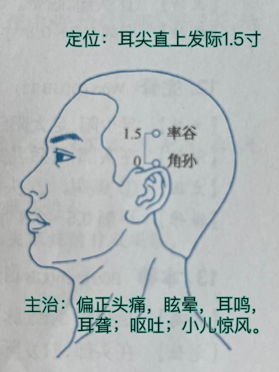 一天记一个穴位—率谷 率谷穴,属足少阳胆经,与足太阳交会.