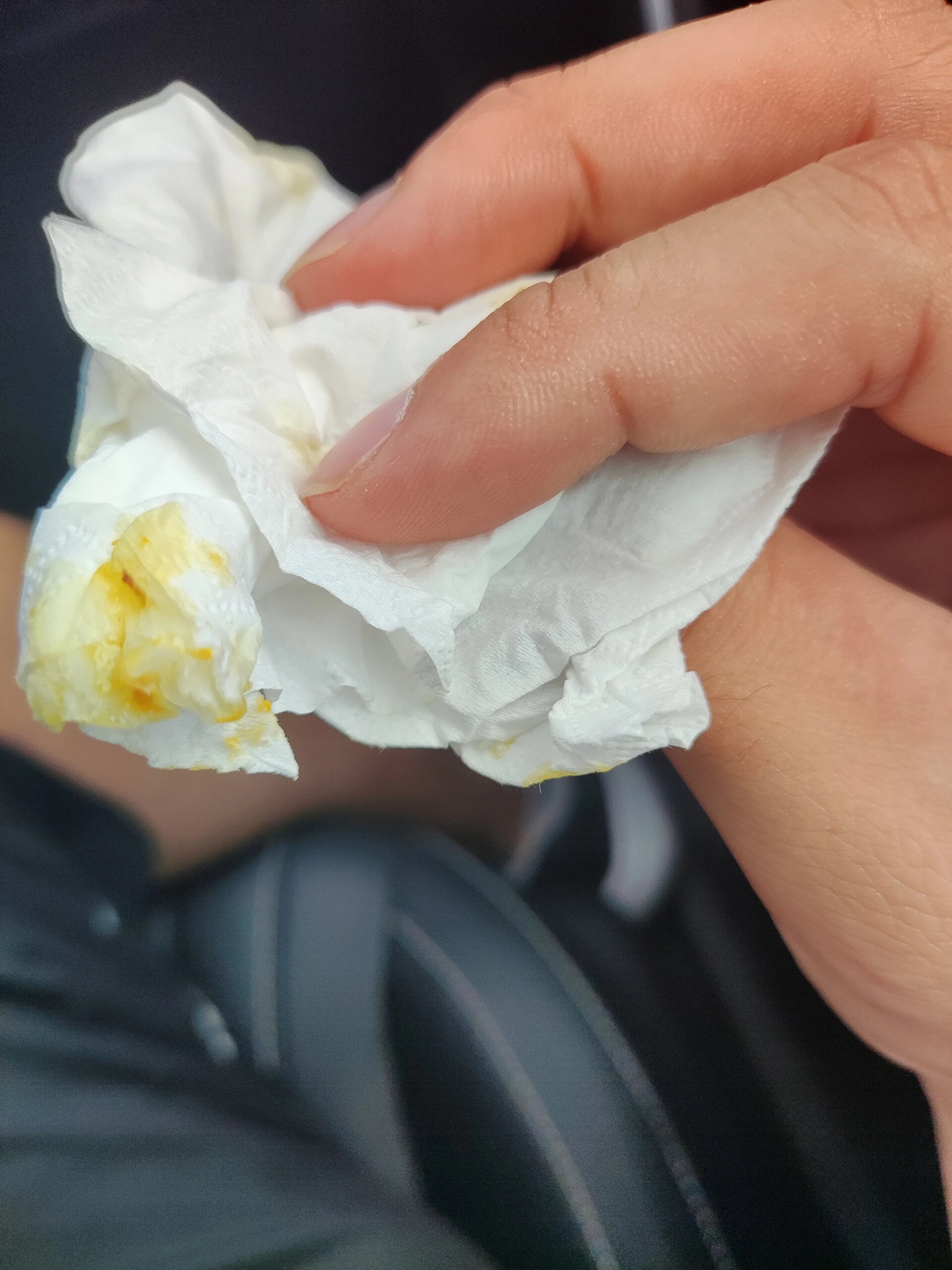 鼻子里流出黄色液体,上颌窦囊肿 鼻子里流出黄色液体大概率是上颌窦