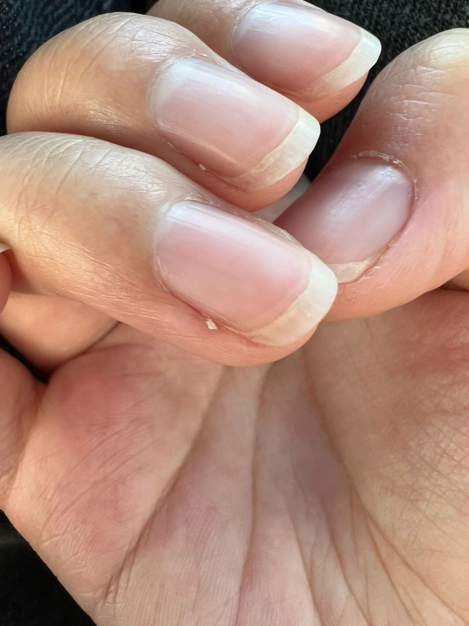 指甲边缘开裂 家人们! 有没有跟我一个情况的集美啊?