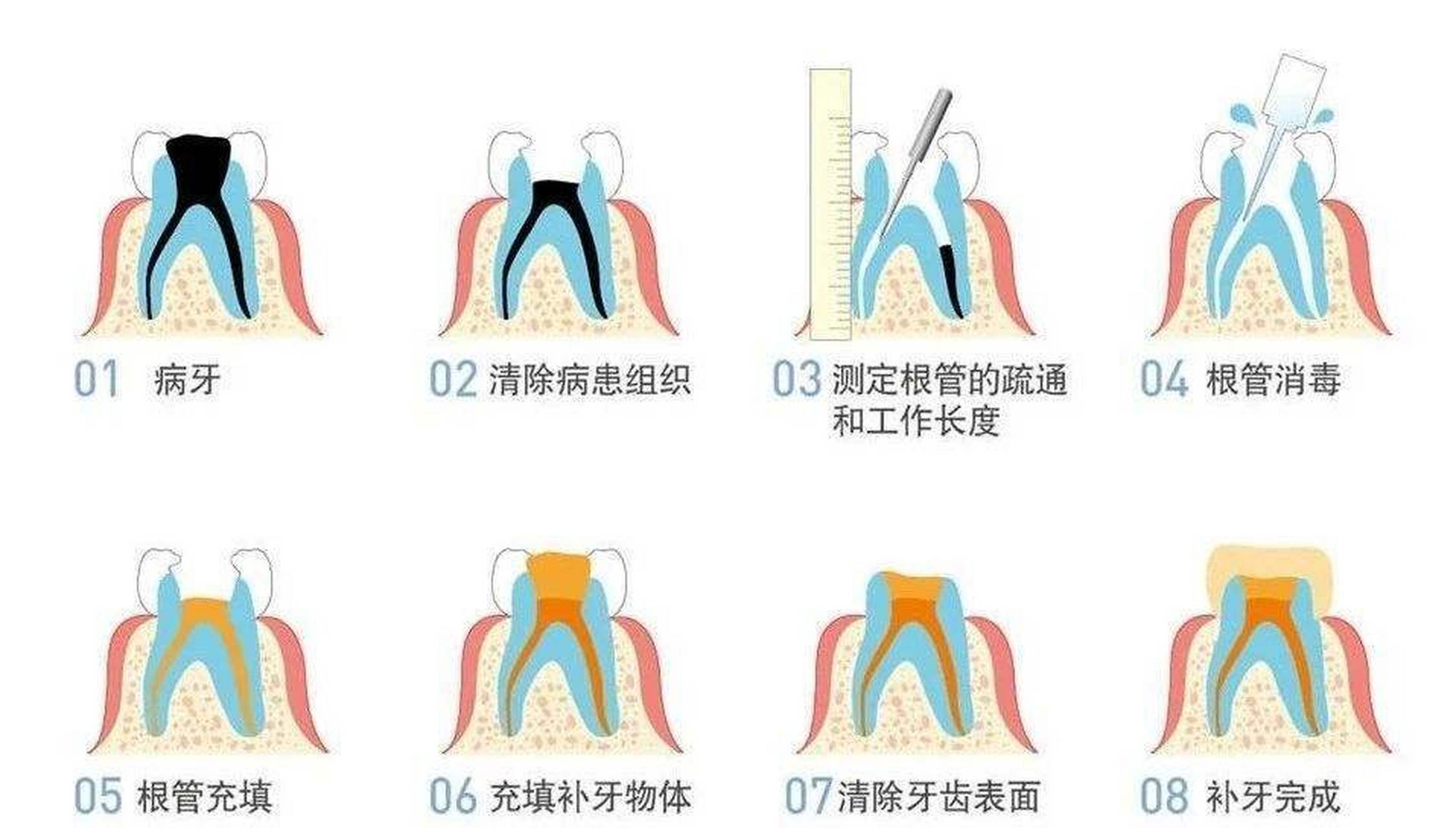 牙齿神经分布图片