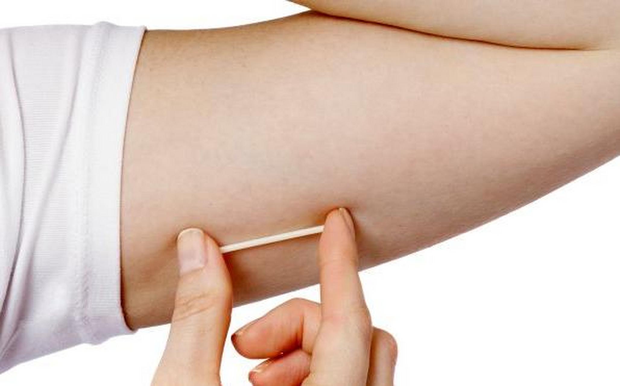 放在手臂上就能避孕,你知道吗?