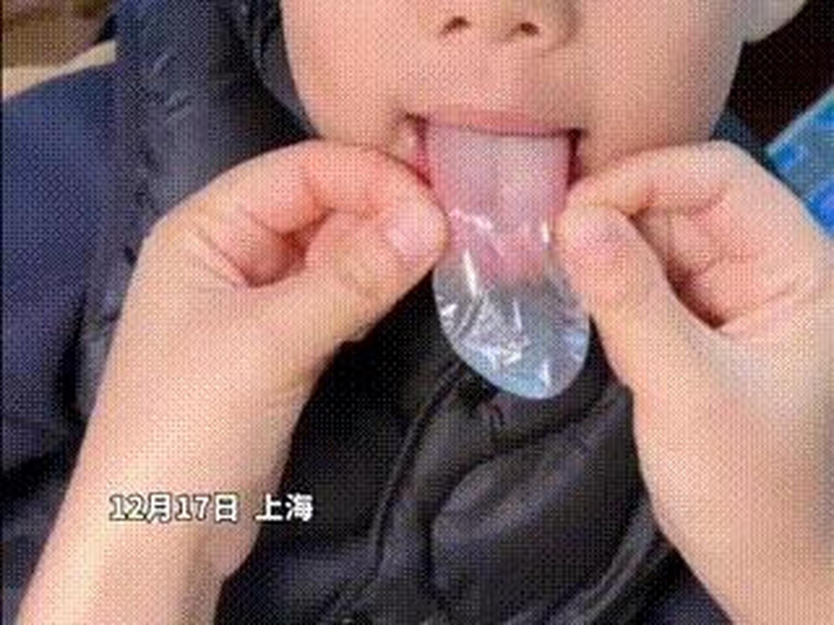 给孩子戴舌套喝中药的家长,哪里做错了?