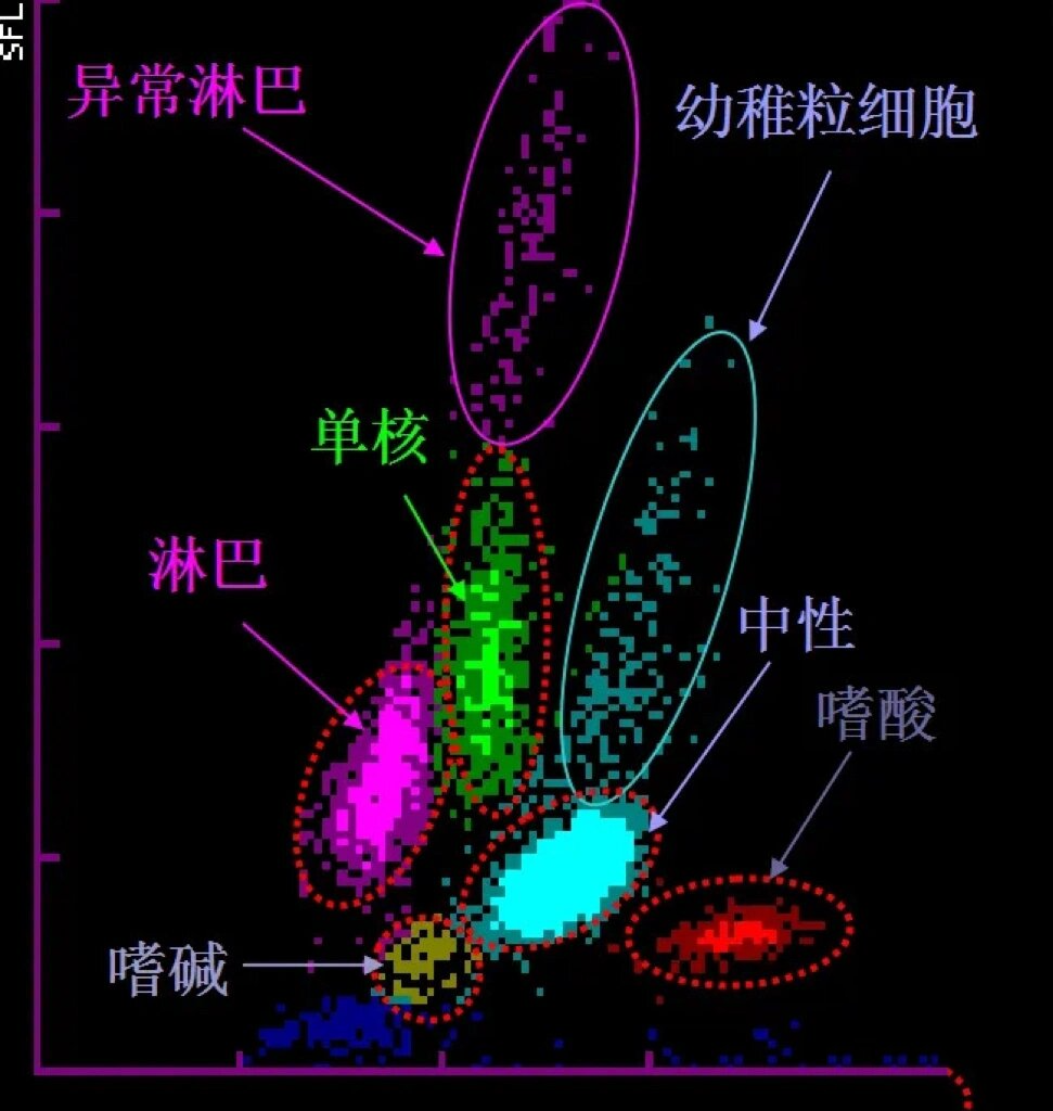 血细胞分析散点图解读图片