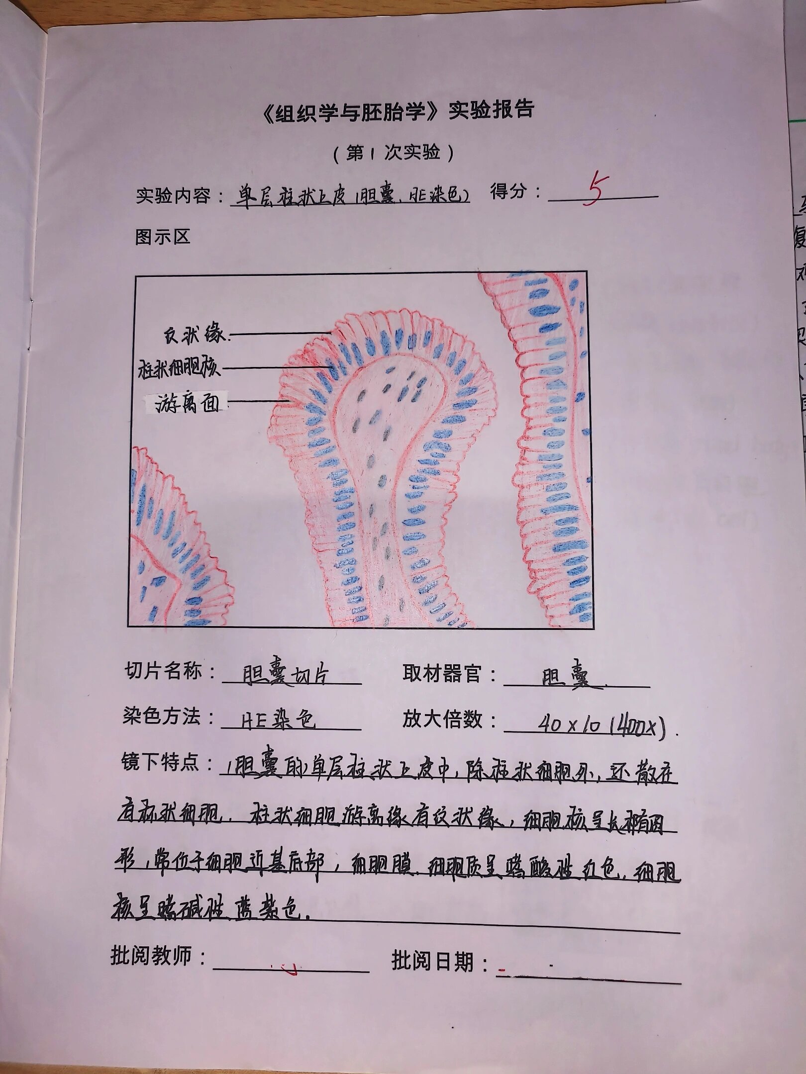 单层柱状上皮实验报告图片