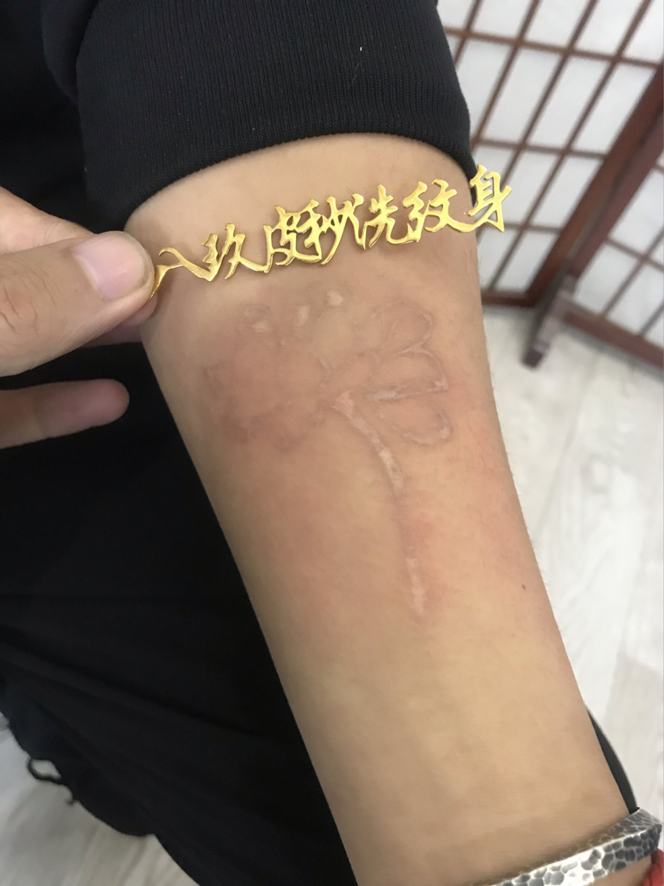 洗纹身之增生纹身 之前在老家可能洗过几次,增生挺严重.