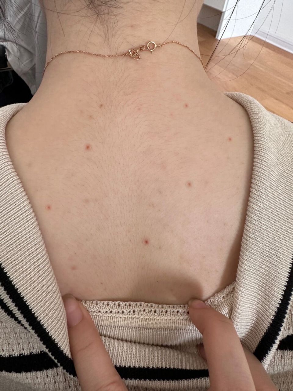 [发怒] 我本来没怎么当回事,但是今早上起来觉得后