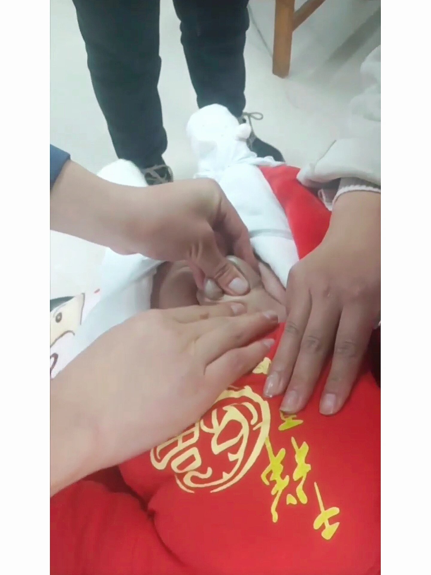 鼓包好大!宝宝腹股沟疝气(严重)掉到阴囊!