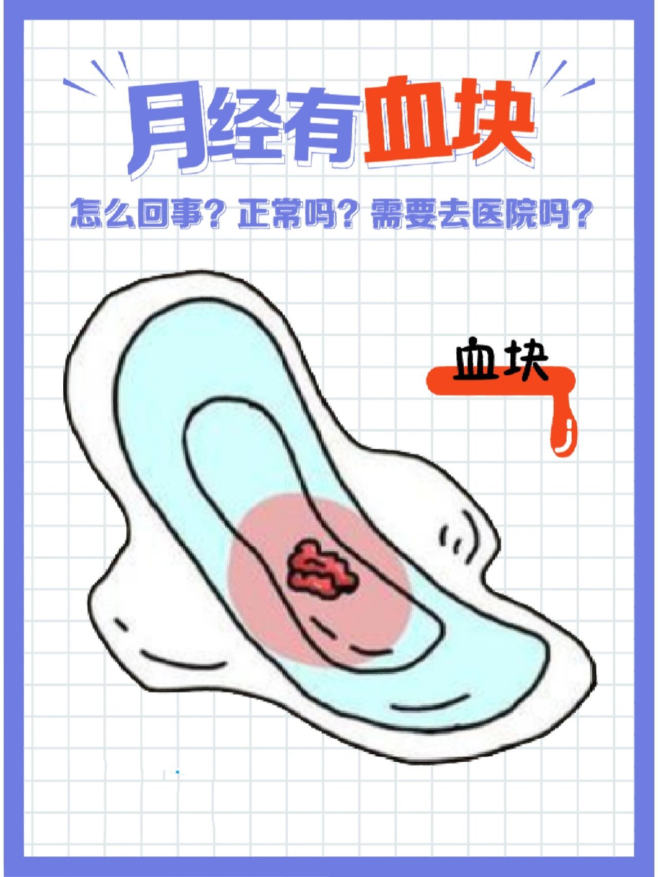 月经有血块是怎么回事,什么情况下要去医院 经常有姐妹因月经中会夹有
