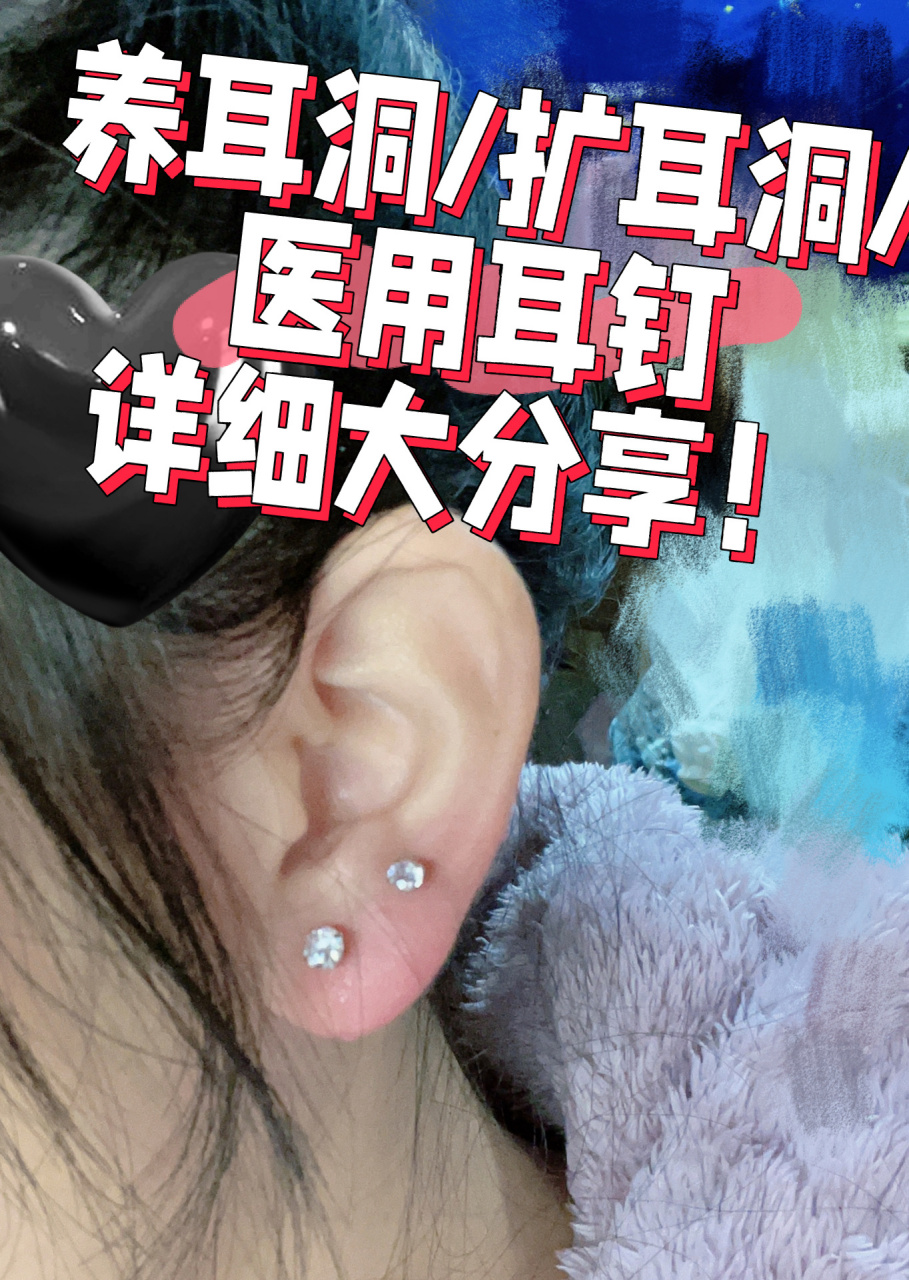 钛钢养耳洞/扩耳洞干货分享!