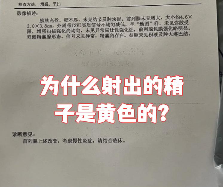 精液为什么是黄色的