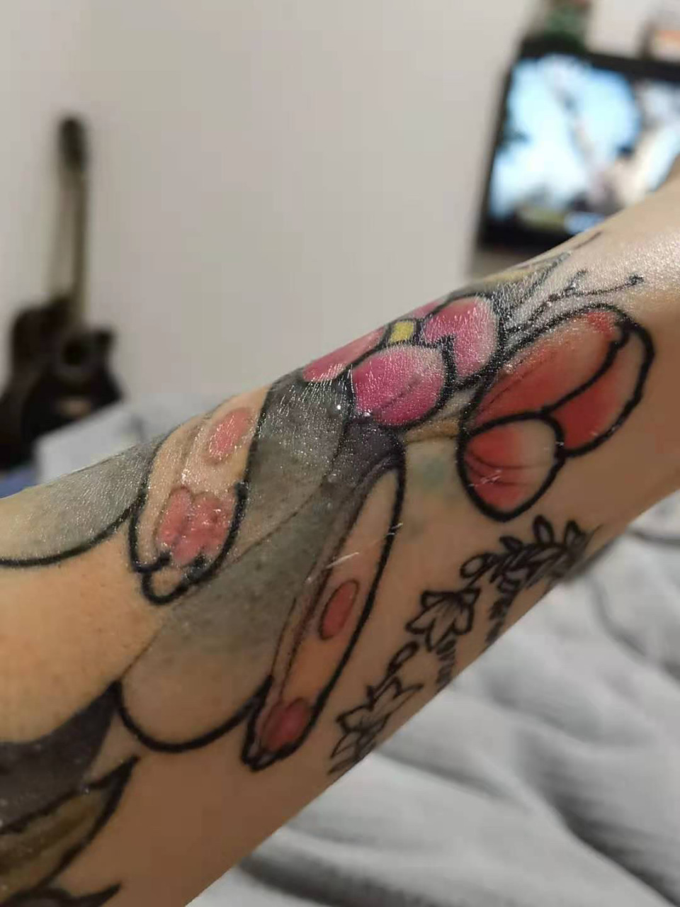 纹身过敏 排异 纹了两年的兔子了,今年夏天晒了太阳过敏后 就开始这样