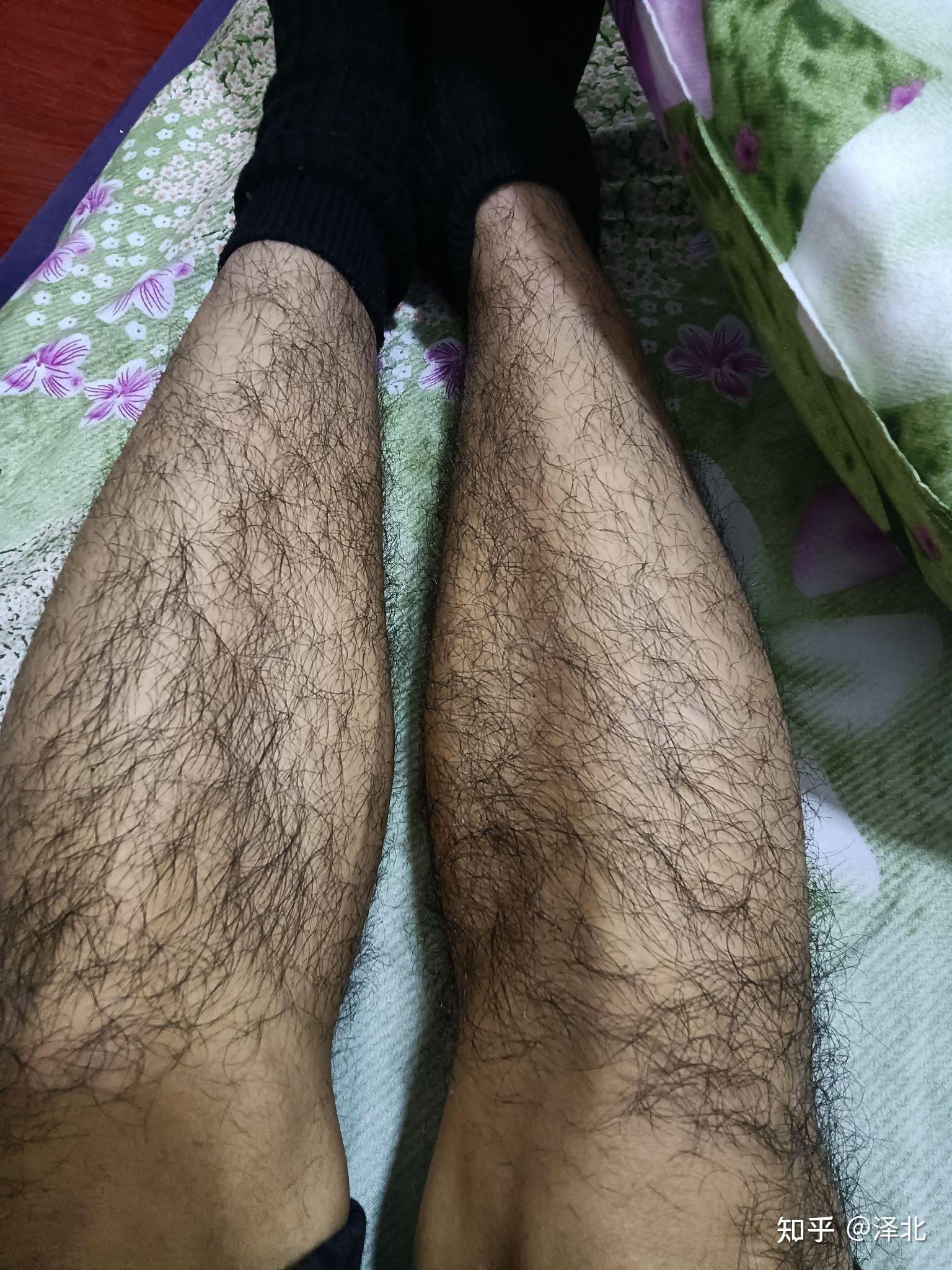腿毛真的会越刮越多吗