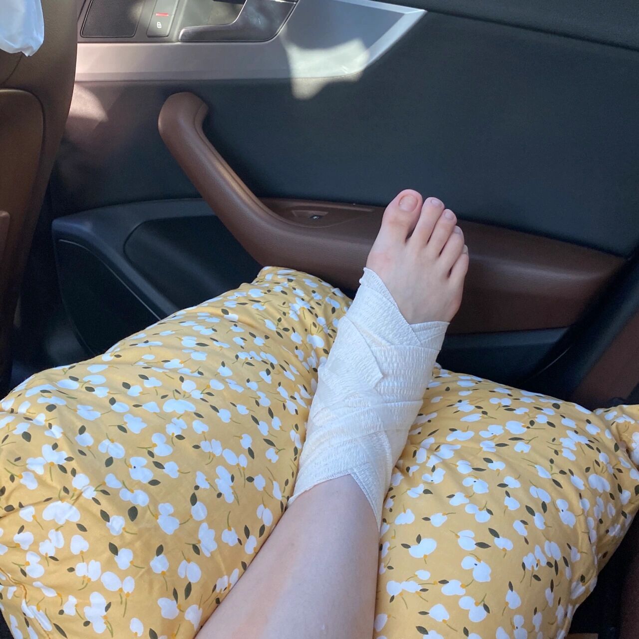 孕期脚背扭伤 今天 在拿外卖的路上不小心把右脚扭了 整个过程都是懵