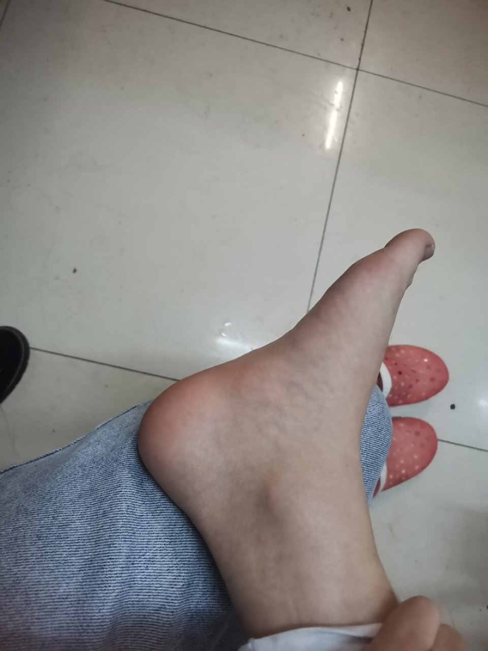 脚足弓内侧肿起 这是怎么了,好久了,姐妹可以帮我看看怎么能消下去?