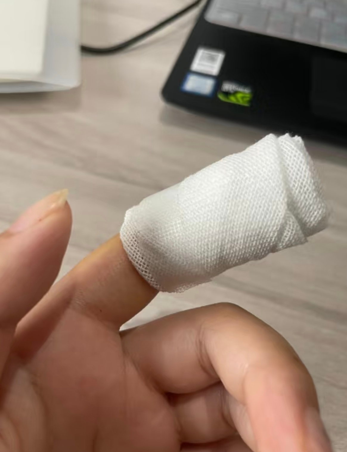 比如之前手指碰伤,扭伤或者活动太多,会导致局部肌肉粘连,僵硬,甚至