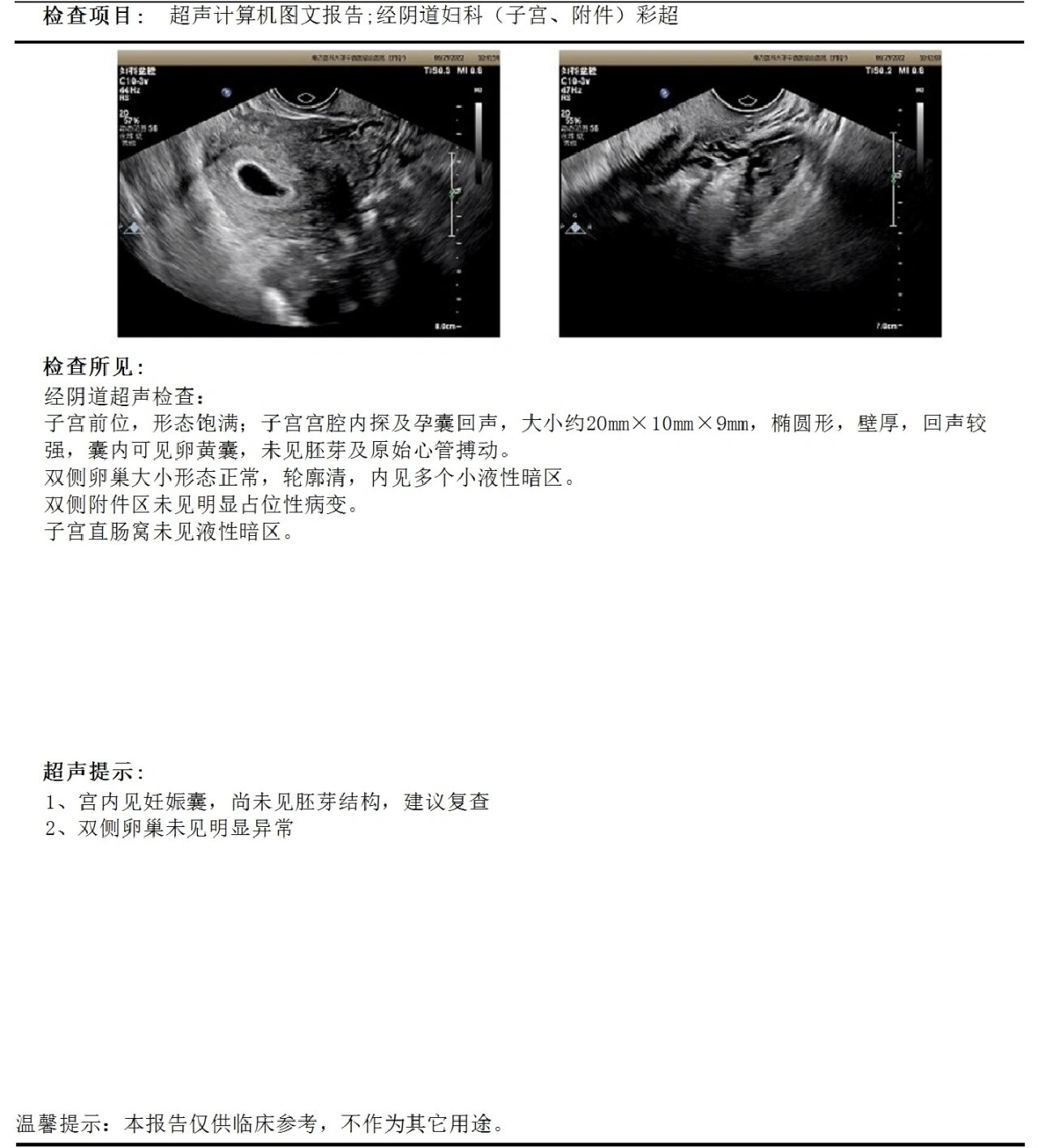 孕期第一次阴超 囊内可见卵黄囊