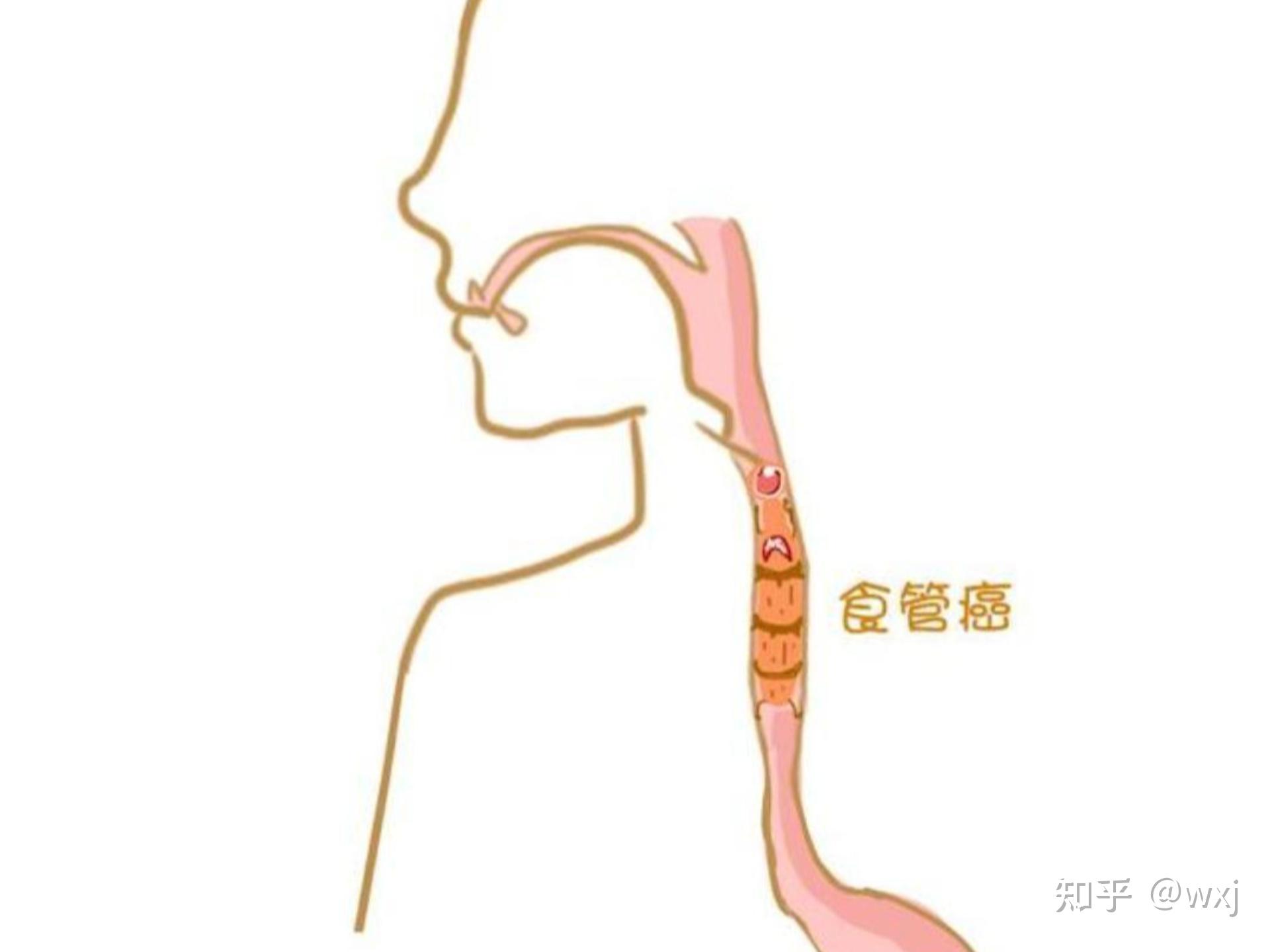 食管有多长图片