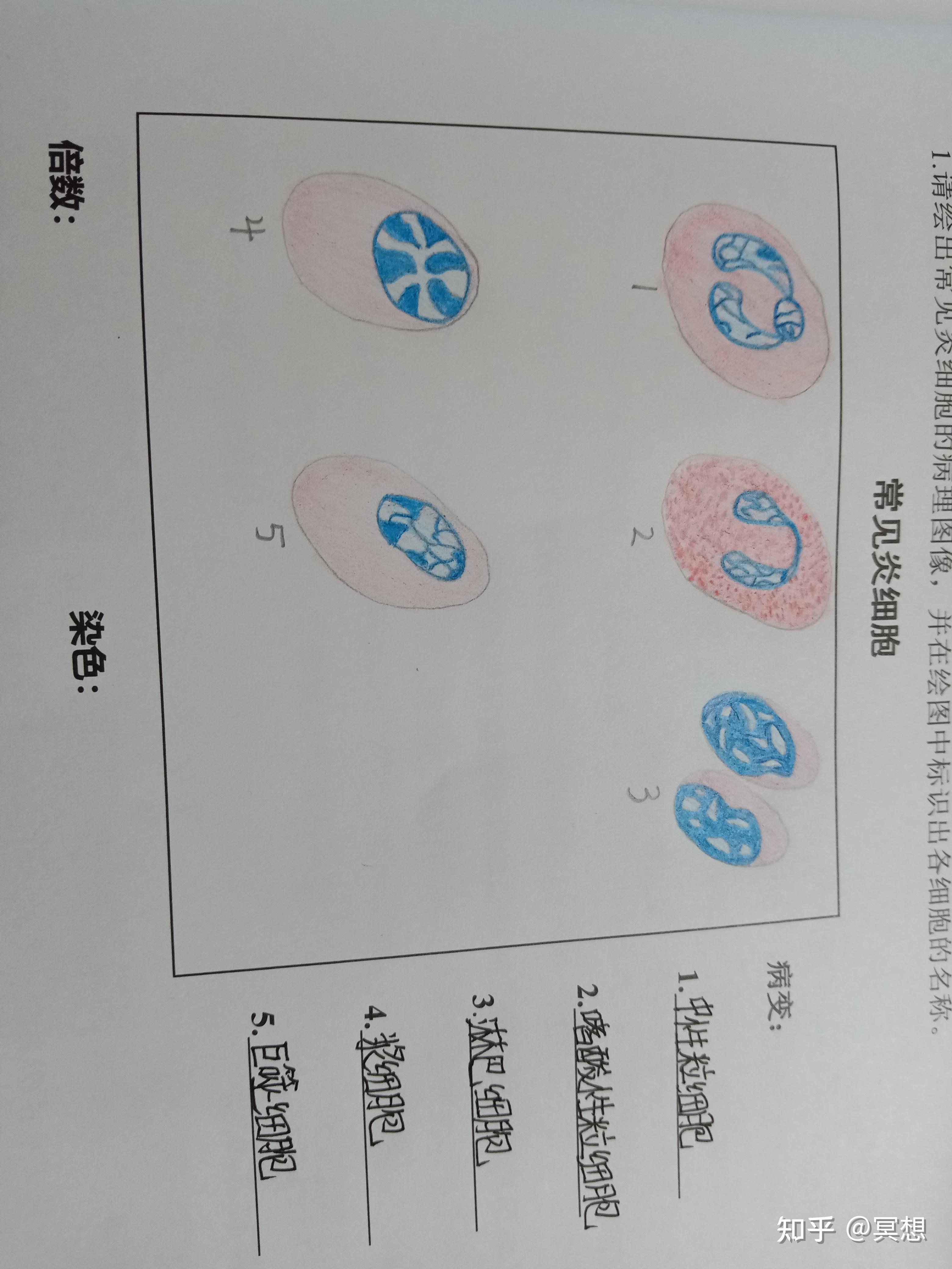 六种炎细胞手绘图图片