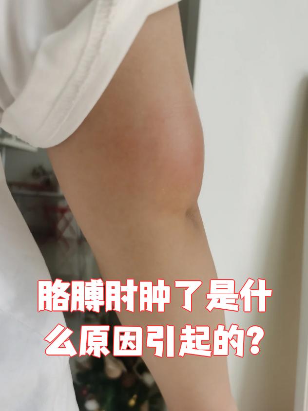 但毛囊炎,淋巴水肿,脂肪瘤,血栓,心肾功能不全也可能引起肿胀