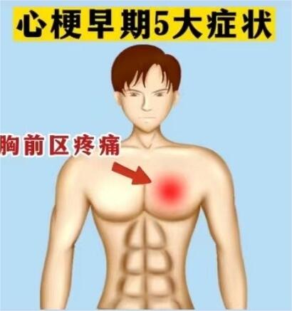 心梗早期症状,这5点很关键!