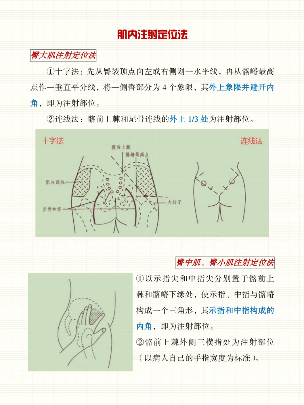 护理专业备考之肌内注射定位法