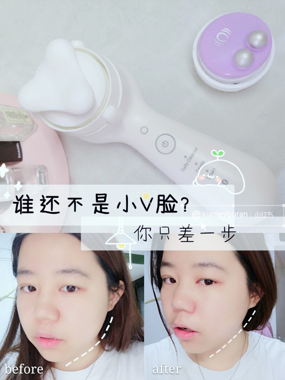 95之前已经说过了这个科莱丽mia smart声波78提拉美容仪,今天我又