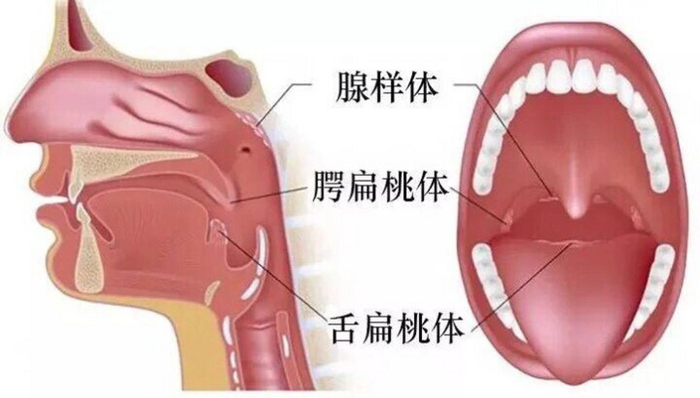 腭扁桃图片