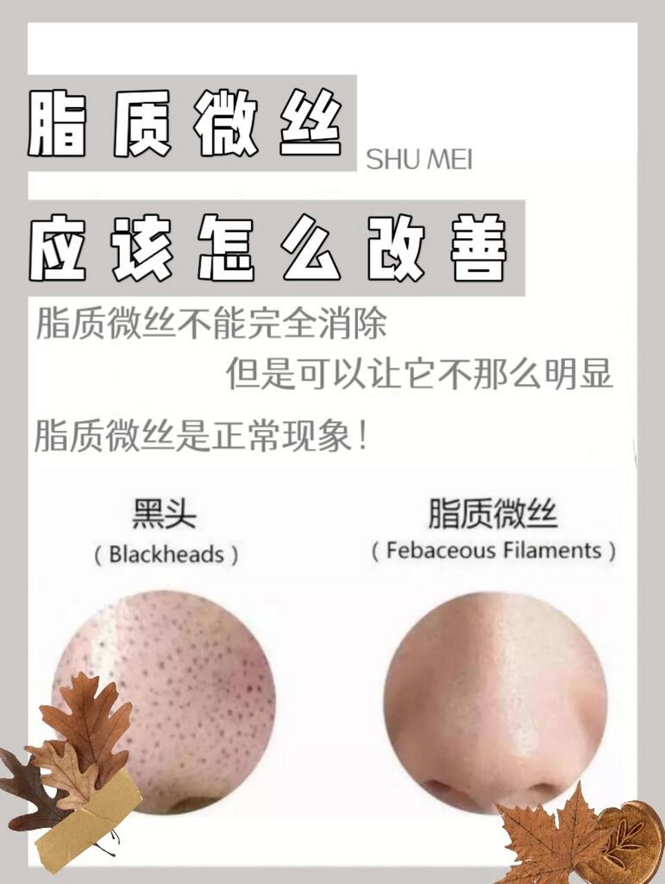 脂质微丝怎么减少 1,自然祛除:脂质微丝9199一般在28天左右就会被