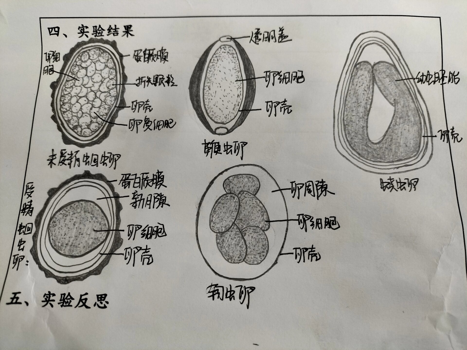 人体寄生虫学手绘图 医学生寄生虫学 线虫纲五种手绘图 未受精蛔虫卵