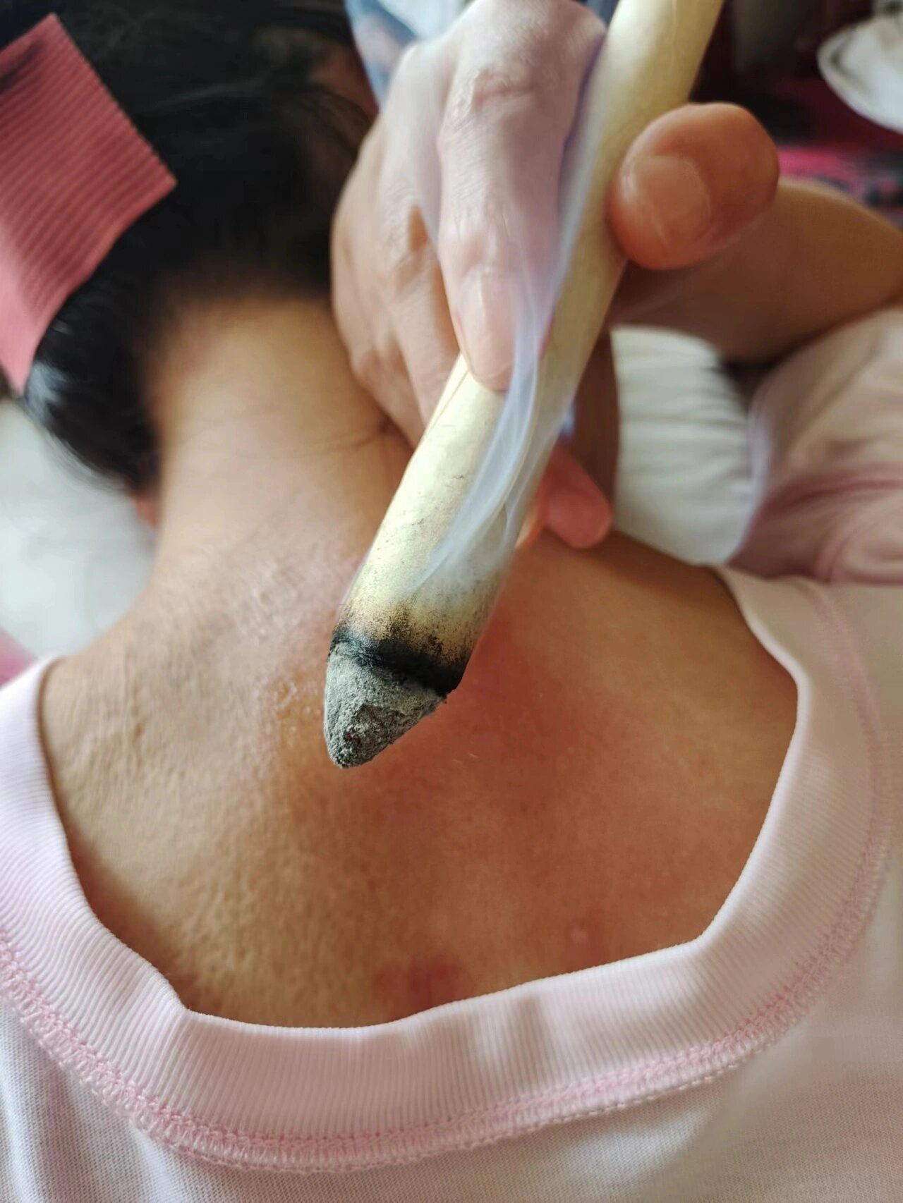 关于感冒,咳嗽,发烧抗炎第一的大椎穴