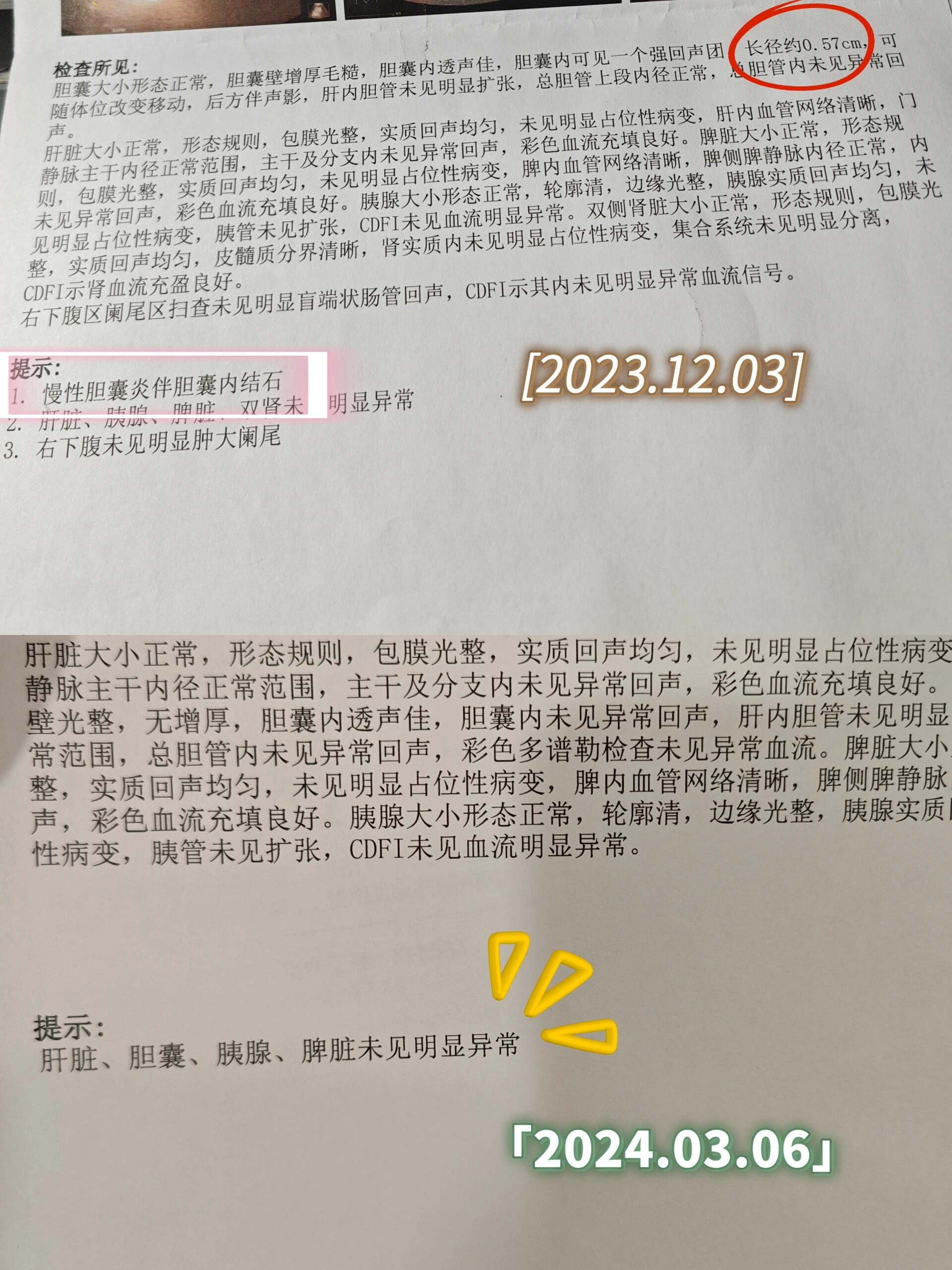 医生看我年轻,先开药吃着,吃三个月看看胆结石会不会变小或者碎掉.