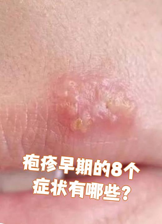  最近病毒性感冒症状有哪些表现图片(最近的病毒感冒)