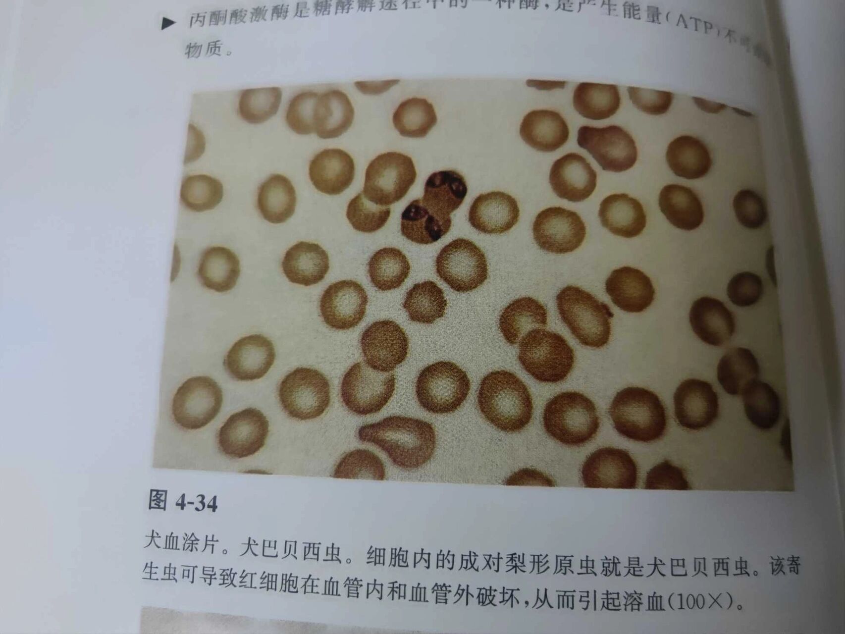 发现血液寄生虫——巴贝斯虫