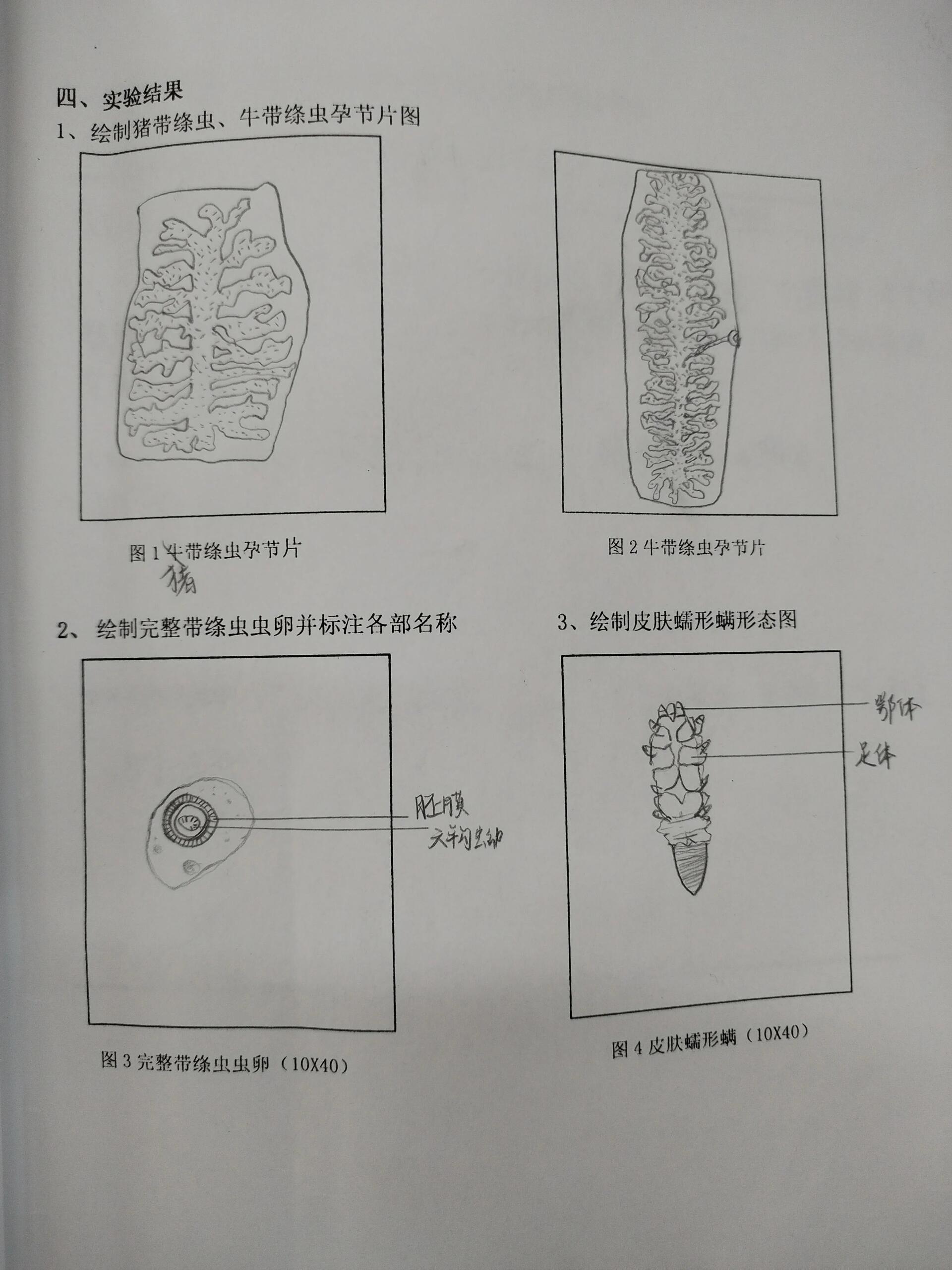 绦虫纲虫卵绘图及区分表格分享