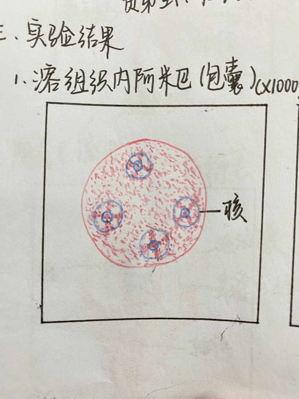 疟原虫小滋养体手绘图图片