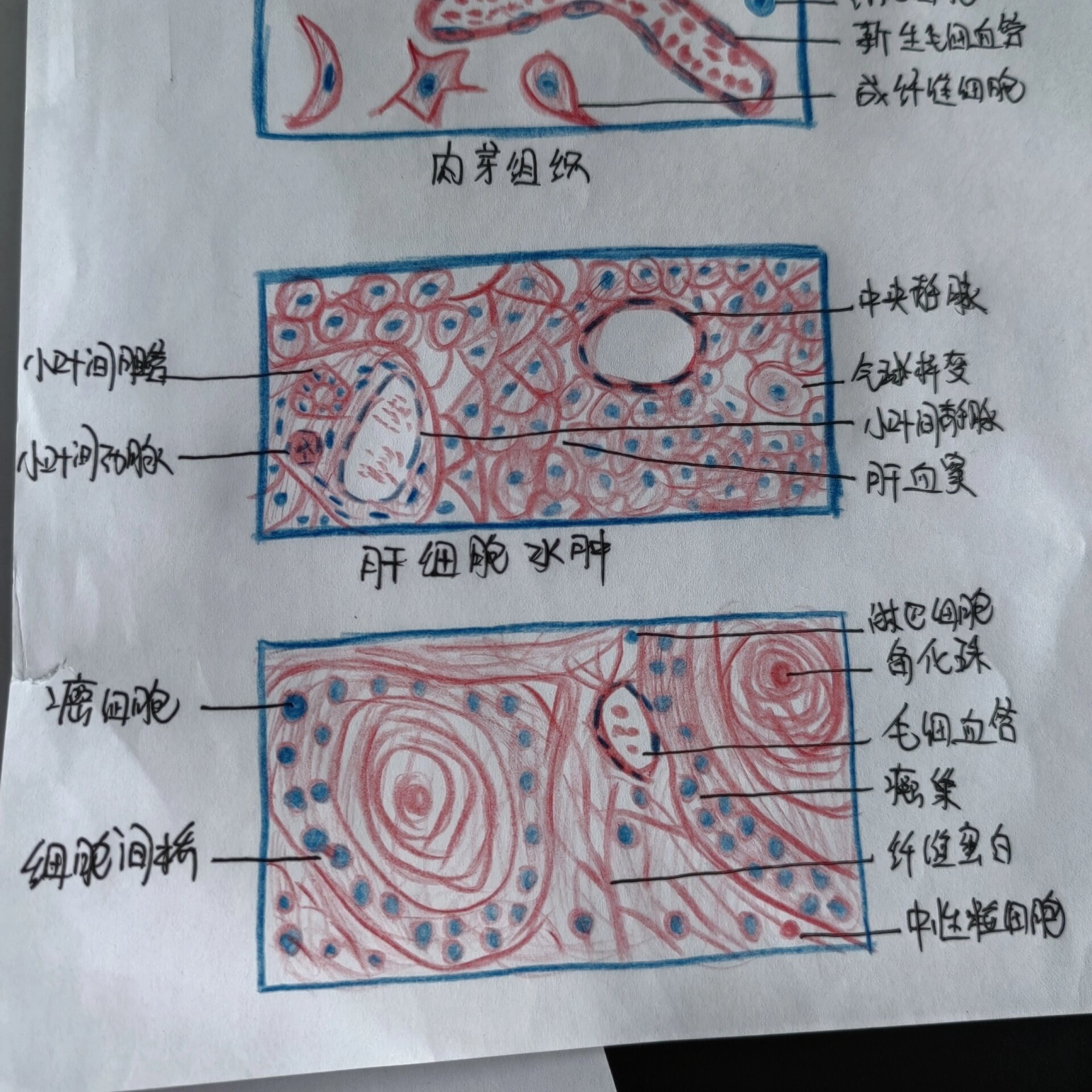 肝细胞索图片