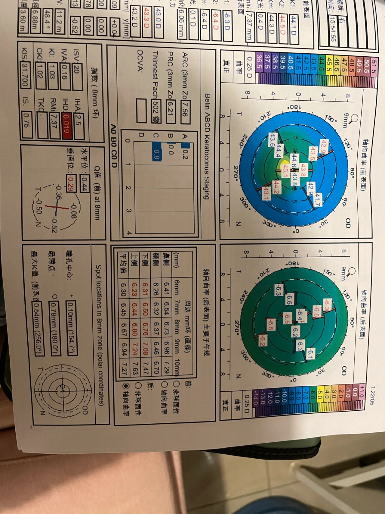 角膜地形图复查图片