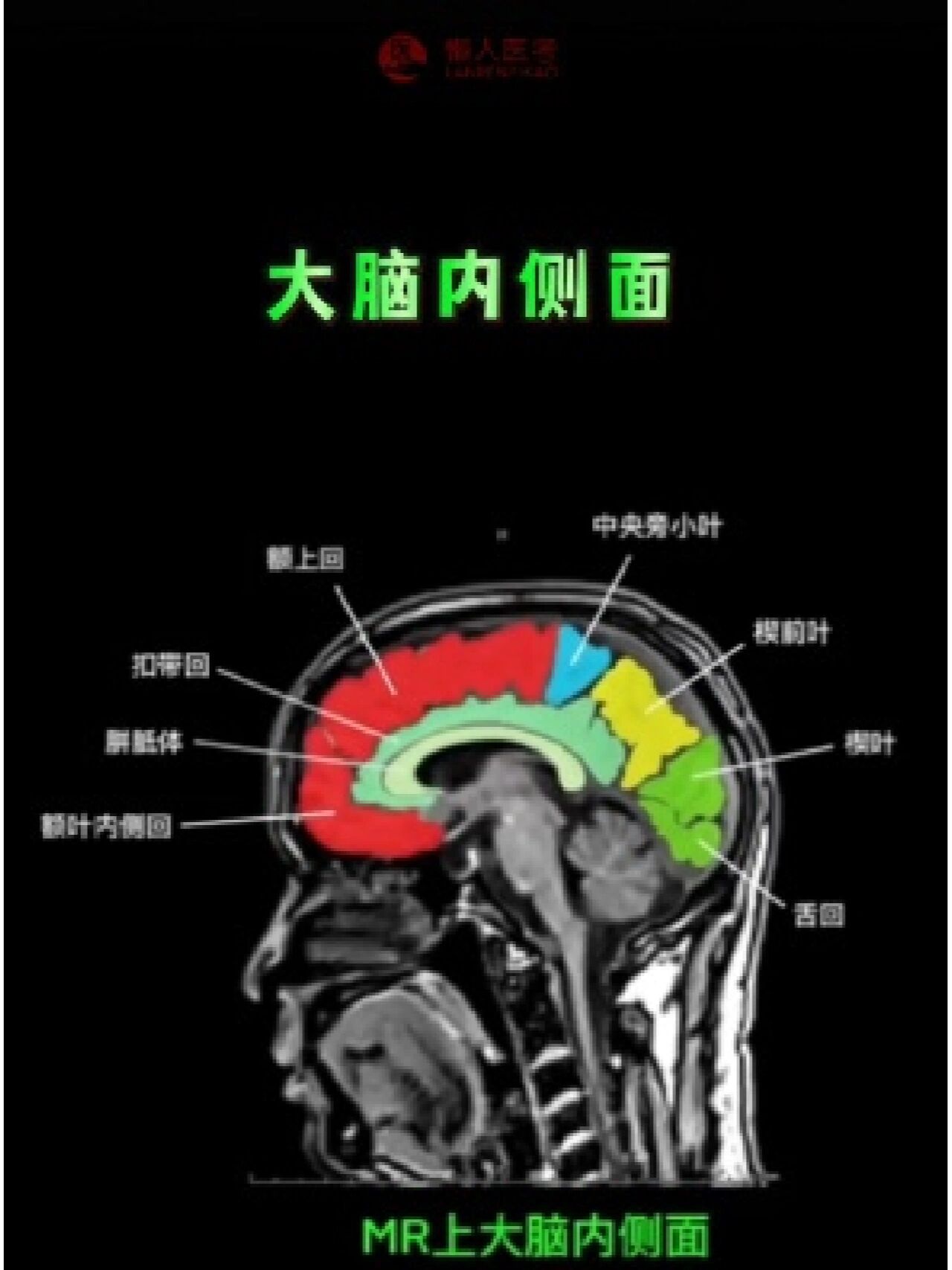 大脑基底节区也叫做基底核区,是埋藏在双侧大脑半球深部的灰质核团