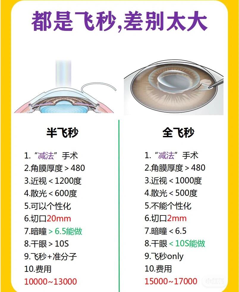 近视手术过程图片