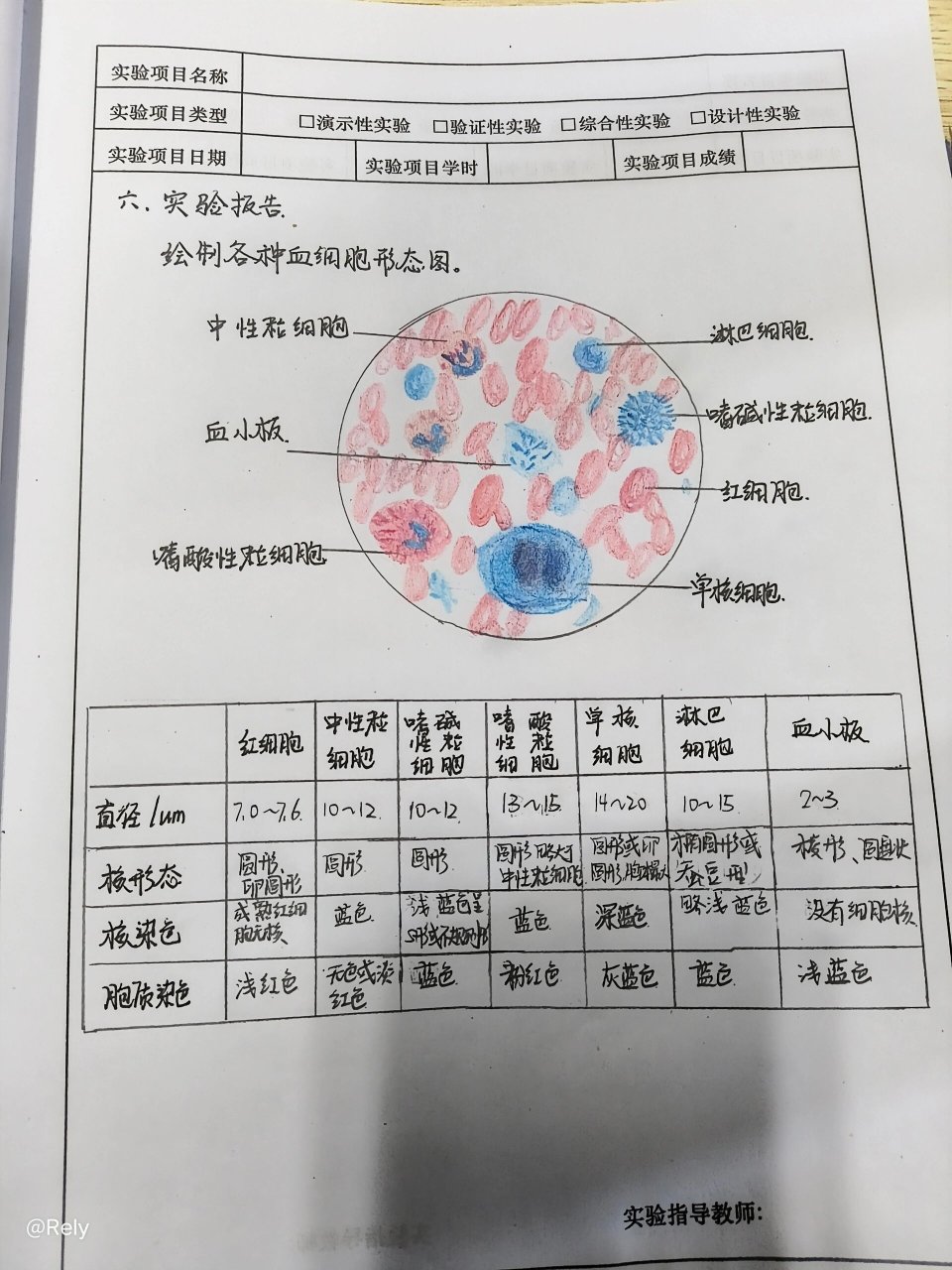 血涂片的制备与观察 #医学生笔记# #自己的血液自己观察