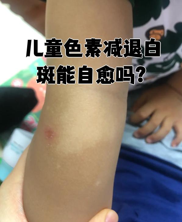 如果是湿疹,皮疹,花斑癣或白色糠疹这些炎症性皮肤病或免疫问题导致