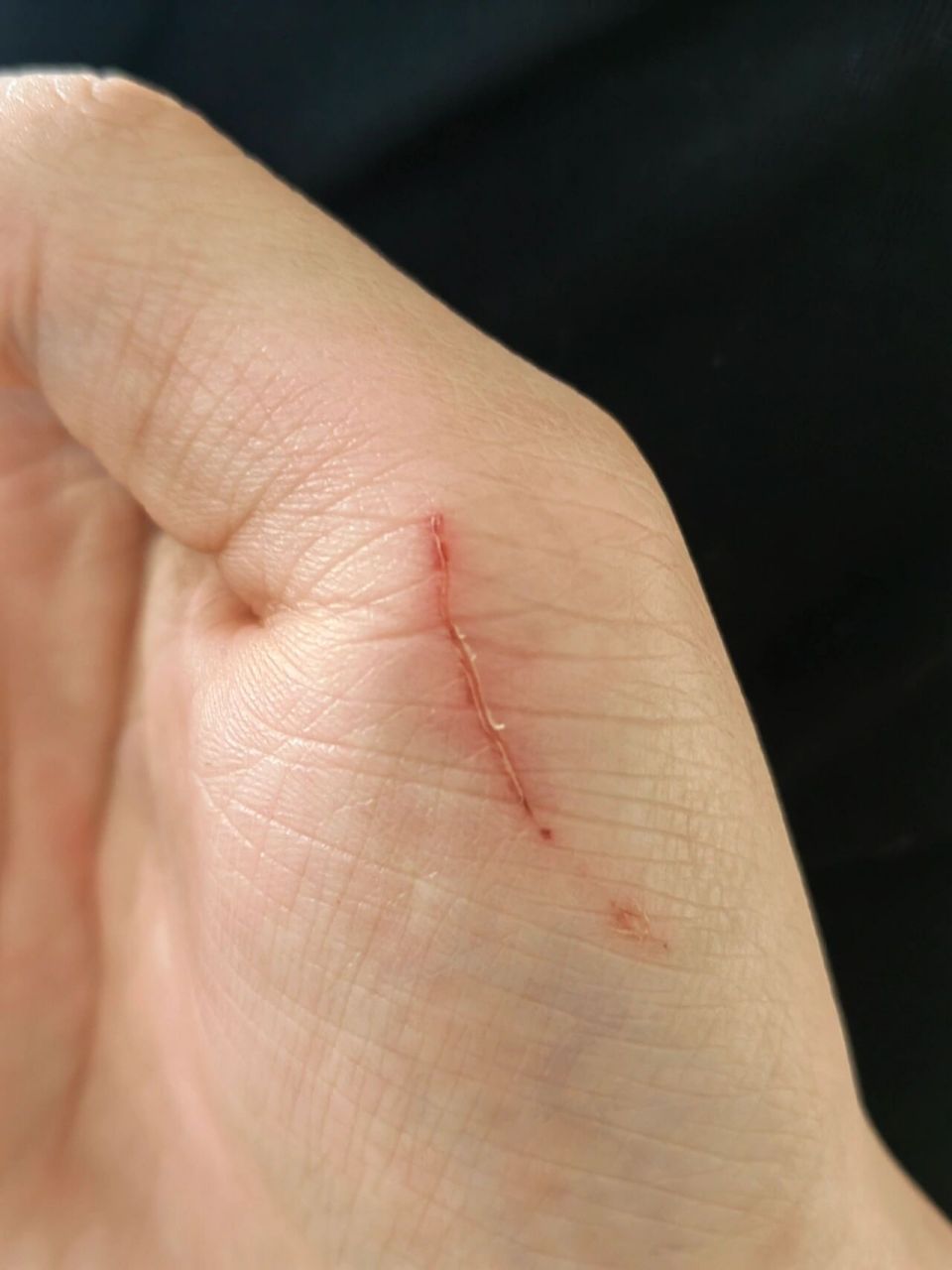 被小狗牙齿划伤了 想问一下姐妹们被家里小狗的尖牙不小心划伤了,必须