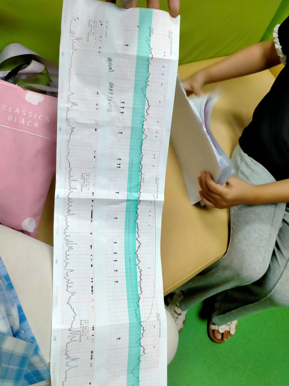 胎心监护不过关说胎儿缺氧,建议马上住院.