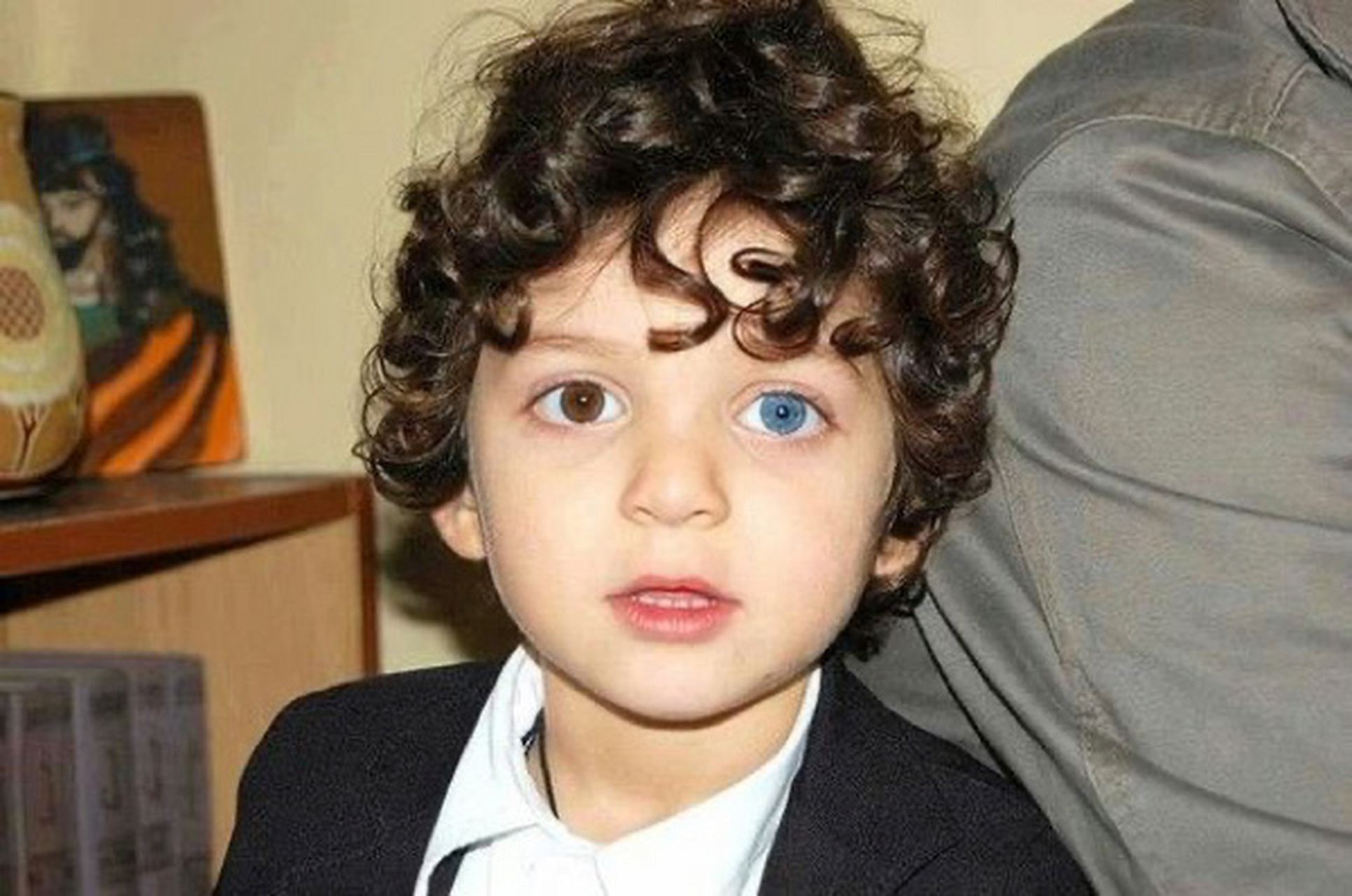 虹膜异色症,另称异色瞳(英语:heterochromia iridum),是一种身体页＃