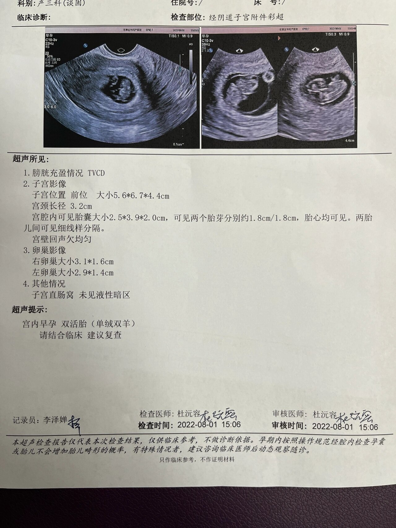 35天孕囊大小图片图片