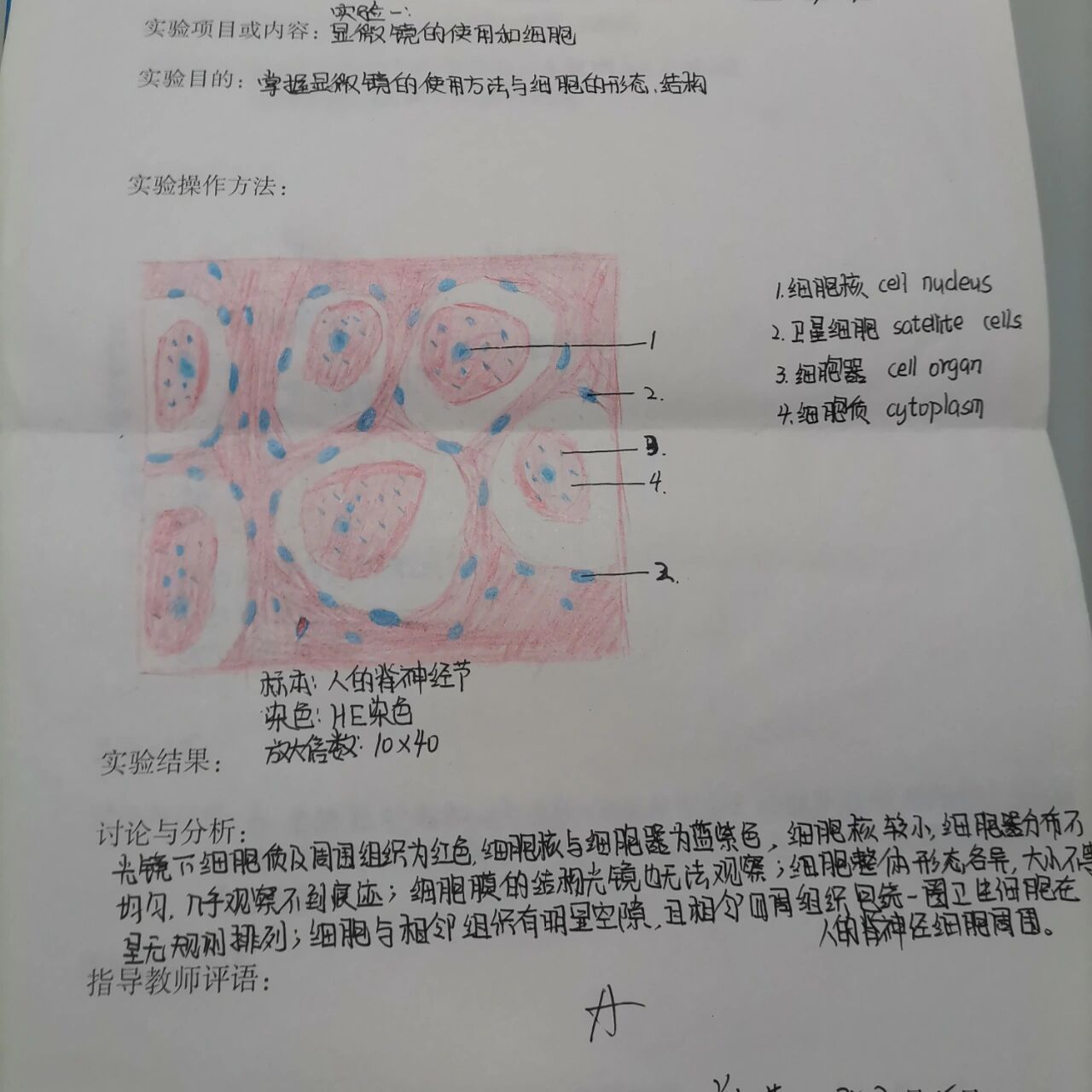 单层柱状上皮(胆囊) 3.血涂片 4.心肌细胞 5.神经组织(脊髓神经元)